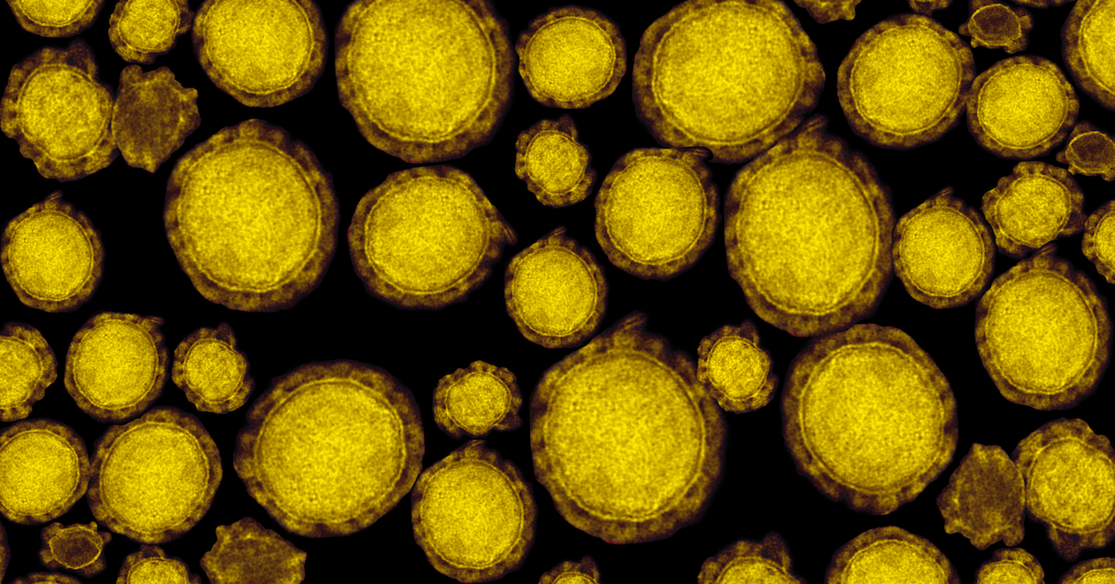 Detail of ultraestructure of deadly coronavirus particles under transmission electron microscopy
